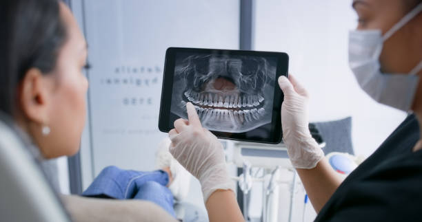 Licensed Root Canal Treatment service in South Jacksonville, IL - Smile Center Dentistry